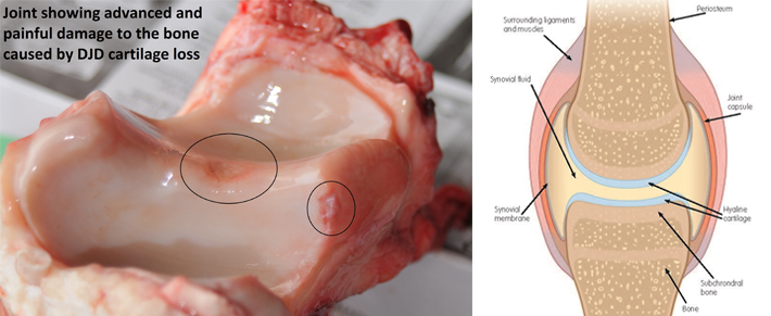 Deterioration of cartilage, underlying bone and joint fluid